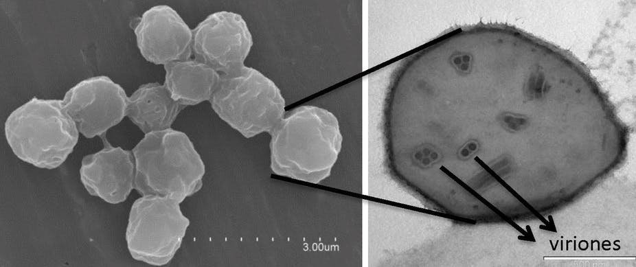 Baculovirus, un aliado en la lucha contra la Covid-19